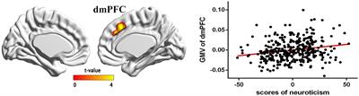 Regional gray matter volume mediates the relationship between neuroticism and depressed emotion